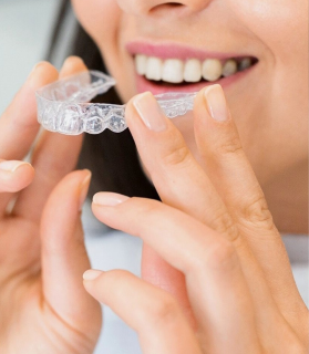 Before Invisalign treatment